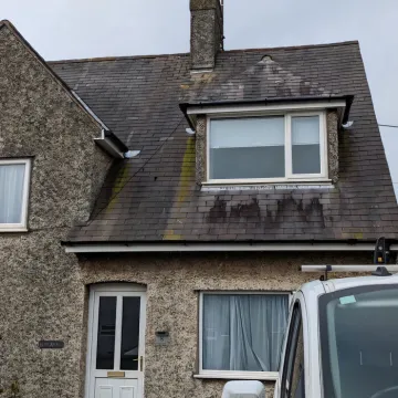 Fascia 4 – Before 2