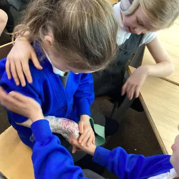 Y3 burns and scalds2