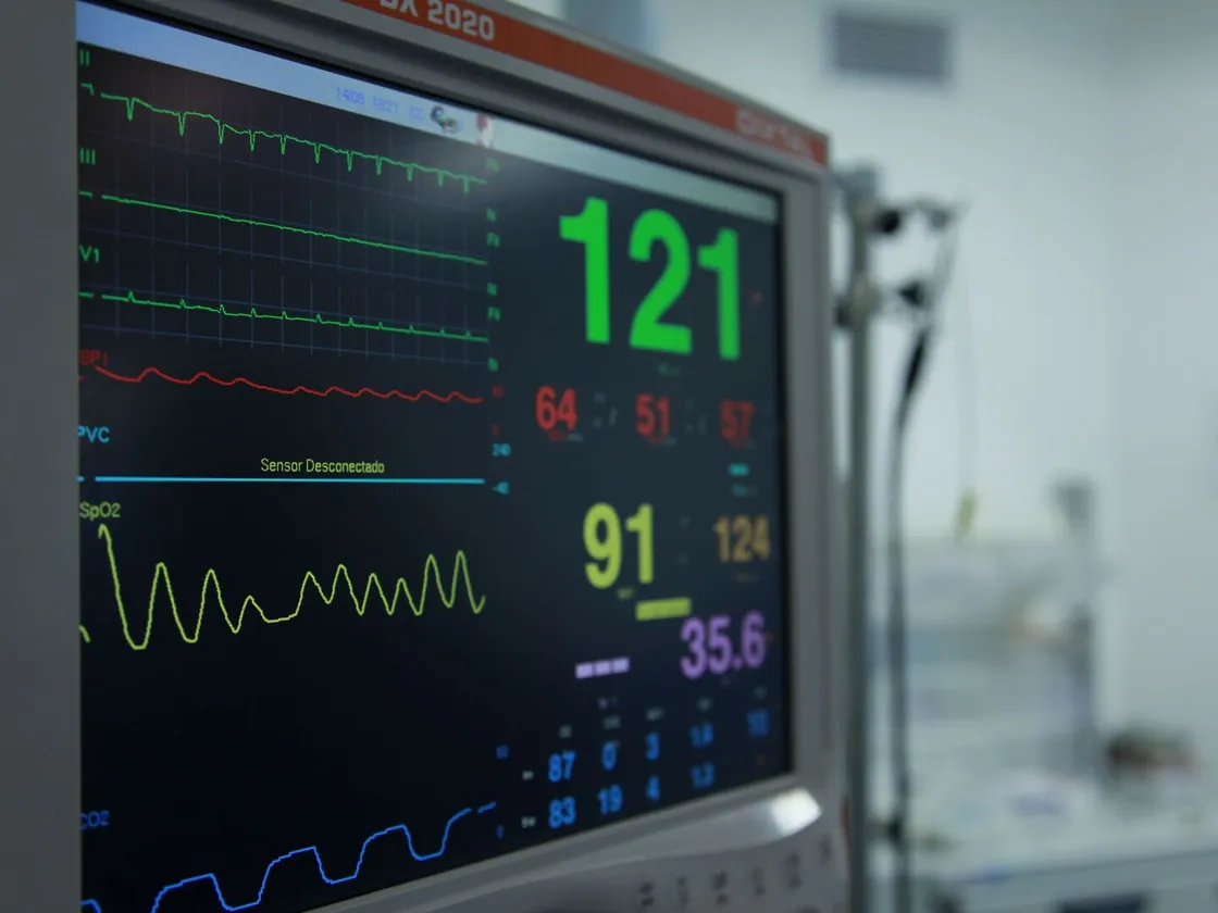 Vital signs monitor in intensive care