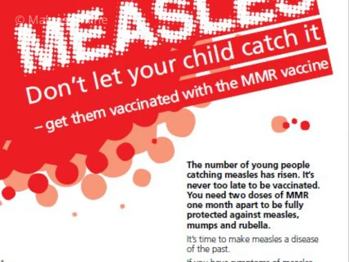 Measles